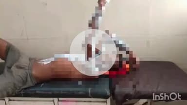 नानपारा: सिलेटनगंज में गैस सिलेंडर में रिसाव से झुलसे युवक का इलाज जारी