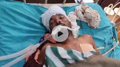 लाडपुरा: जयपुर से गांव जा रहा युवक बारां के निकट ट्रेन से गिरकर गंभीर घायल, मेडिकल कॉलेज अस्पताल में भर्ती, उपचार जारी