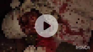 जानसठ: भोपा क्षेत्र में हाईवे मार्ग पर अज्ञात वाहन की टक्कर से बाइक सवार हुआ गंभीर घायल, पुलिस ने अस्पताल में कराया भर्ती