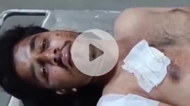 लाडपुरा: केशोरायपाटन में युवक पर बदमाशों ने चाकू से किया जानलेवा हमला, घायल युवक का MBS अस्पताल में इलाज जारी