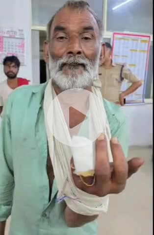 ग्वालियर गिर्द: पड़ाव में पैसों के लेनदेन को लेकर दो मजदूरों में विवाद, एक ने दूसरे की उंगली काटी