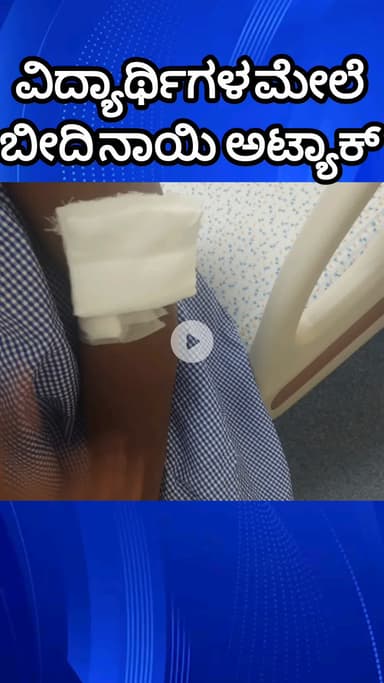 ಬೆಂಗಳೂರು ಉತ್ತರ: ಬೆಂಗಳೂರು ವಿವಿಯಲ್ಲಿ ಬೀದಿ ನಾಯಿ ಕಾಟ, ಡೆಡ್ಲಿ ಡಾಗ್ ಅಟ್ಯಾಕ್‌ಗೆ ಓರ್ವ ವಿದ್ಯಾರ್ಥಿನಿ ಗಂಭೀರ