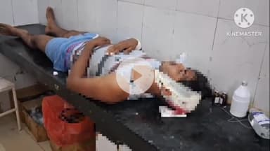 बटियागढ़: लड़ई बम्होरी गांव में दो पक्षों में खूनी संघर्ष, दर्जन भर घायल, बटियागढ़ स्वास्थ्य केंद्र में भर्ती