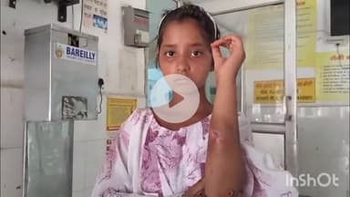 बरेली: उदय भानपुर में बंदरों के झुंड ने घर के बाहर खेल रही किशोरी पर किया हमला, किशोरी को जिला अस्पताल में भर्ती कराया गया