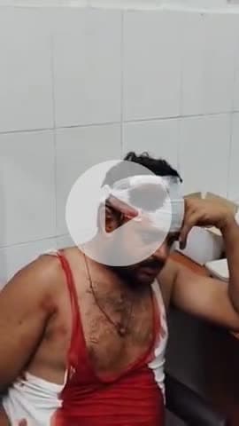 नरवल: सरसौल में दो ट्रकों की टक्कर के बाद, एक ट्रक चालक ने दूसरे चालक को लोहे की रॉड से पीटा