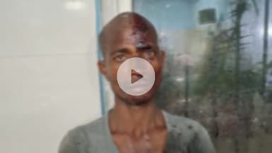 उदवंत नगर: कल्याणपुर गांव में खेत में बकरी घुस जाने के विवाद में दो पक्षों के बीच जमकर हुई मारपीट