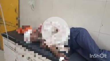 बहराइच: सतपारा इलाके में खाद लेकर आ रहा बाइक सवार सड़क हादसे में घायल, इलाज जारी