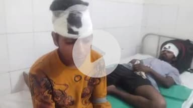 फतेहाबाद: आगरा-लखनऊ एक्सप्रेसवे के 20वें माइल स्टोन पर बस ने पीछे से ट्रक में मारी टक्कर, एक दर्जन सवारियां घायल