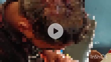 बरेली: सिरौली थाना क्षेत्र के मोहल्ला ग्यास में दबंगों ने घर में घुसकर की मारपीट, कई लोग हुए घायल