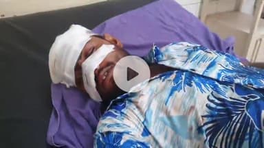 रामपुर: मिल्क जीरो पॉइंट के निकट अज्ञात वाहन ने 4 युवकों को मारी टक्कर, चारों घायल, एक जिला अस्पताल में भर्ती, 3 रैफर