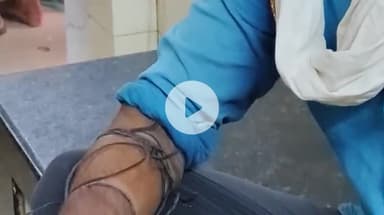 पडरौना: कुशीनगर के धीर पट्टी गाँव में करतब दिखा रहे सपेरे को उसके ही कोबरा ने डसा, अस्पताल में भर्ती, इलाज जारी