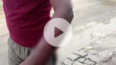 फतेहाबाद: फतेहाबाद के ग्राम तुस्सी पुरा में पागल कुत्ते का आतंक, 8 लोगों को काटकर किया घायल, सीएचसी में भर्ती