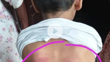 नूह: गाँव छछेड़ा के न्यू प्रभात स्कूल में तीसरी कक्षा की छात्रा से मारपीट, मामला दर्ज