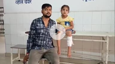 बरेली: थाना इज्जत नगर क्षेत्र के अब्दुल्लापुर माफी निवासी बच्ची पर बंदरों ने किया हमला, घायल