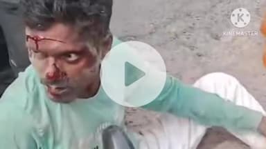 नरपतगंज: नरपतगंज एनएच के पछगछिया के समीप ट्रक की ठोकर से बाइक सवार दंपति सहित चार लोग अलग-अलग जगह हुए घायल