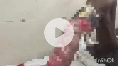 बहराइच: मधवापुर में पुलिया के पास भरे पानी में छिपे मगरमच्छ ने व्यक्ति पर किया हमला, महिला ने अपनी साड़ी से बचाई पति की जान