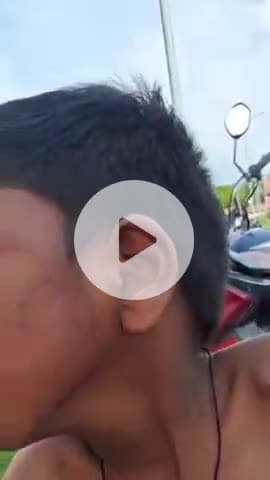 जयसिंहपुर: सराय नौरंग में स्कूल में एलकेजी छात्र को शिक्षक ने डंडे से पीटा, अभिभावक ने कोतवाली में दी तहरीर