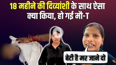 18 महीने की दिव्यांशी के साथ ऐसा क्या किया, हो गई मौ-T | child Malnutrition | MP News | Latest News