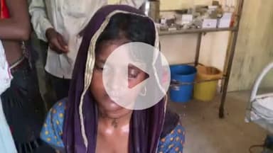 बाह: नौगवां गांव में निहत्थे ही मां ने जंगली जानवर से भिड़कर बचाई बेटी की जान