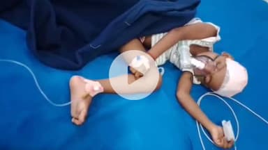 कसिया: कसया में मेला देखने गए परिवार पर हमला, 6 साल की बच्ची के सिर में धंसा बेल्ट का बक्कल, गोरखपुर रेफर