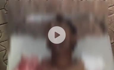 गभाना: सोमना-खैर मार्ग पर करनपुर गांव के पास स्कूटी और बाइक की टक्कर में एक युवक गंभीर रूप से हुआ घायल