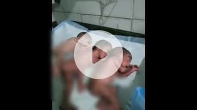 रहुई: सीएचसी रहुई में महिला ने एक साथ तीन शिशुओं को जन्म दिया, क्षेत्र में चर्चा