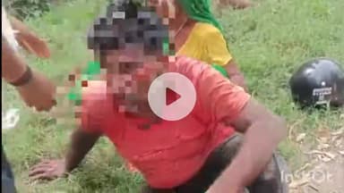 नवाबगंज: जेआईटी चौराहे पर स्कूली छात्र को बचाने के दौरान हादसा, बाइक सवार दो युवक सड़क पर गिरे, एक की हालत चिंताजनक