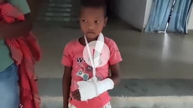 भंडरा: शिक्षा मंदिर या अत्याचार का अड्डा! भंडरा के संत मेरी पब्लिक स्कूल में 8 वर्षीय छात्र की बेरहमी से पिटाई, मामला दर्ज