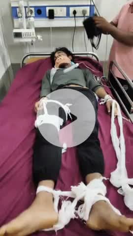 तिल्दा: हाऊसिंग बोर्ड कालोनी कोहका के पास दोपहिया वाहन चालक ने स्कूटी सवार को मारी ठोकर, स्कूटी सवार गंभीर रूप से घायल