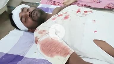 सुपौल: चकला निर्मली में पुरानी रंजिश के चलते पति-पत्नी पर हमला, दोनों गंभीर रूप से घायल