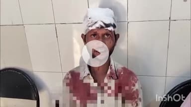 बरेली: प्रेम नगर थाना क्षेत्र के सीआई पार्क में दबंगों ने युवक के साथ की मारपीट