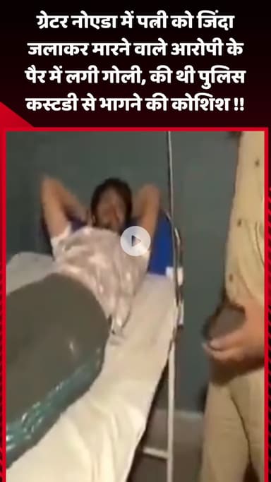 गौतम बुद्ध नगर: ग्रेटर नोएडा में पत्नी को जिंदा जलाकर मारने वाले आरोपी के पैर में लगी गोली, पुलिस कस्टडी से भागने की कोशिश की थी