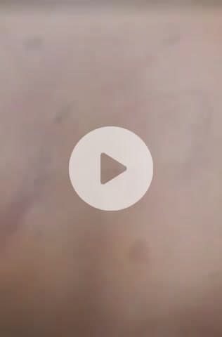 नवाबगंज: देवा रोड पर आधी रात को काका होटल के पास युवक पर लाठी-डंडों और हथियारों से किया गया हमला, कई आरोपी नामजद