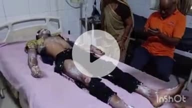 चित्तौड़गढ़: कुंभा नगर में एक घर में तेज धमाके के साथ फटा रेगुलेटर, हादसे में कॉलेज छात्र बुरी तरह झुलसा