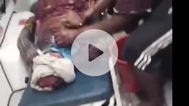 फतेहाबाद: निबोहरा के ग्राम बिहारीपुरा में कुल्हाड़ी लेकर घर में घुसे युवक ने महिला समेत तीन को किया घायल, अस्पताल में भर्ती