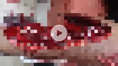 नौगावां सादात: नौगांवा-अमरोहा रोड पर अज्ञात वाहन की टक्कर से बाइक सवार घायल, हालत गंभीर