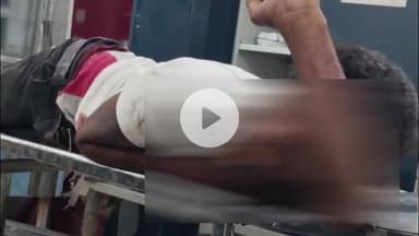 पीरटांड: पीरटांड़ रोड जोड़ापहड़ी के पास सड़क हादसे में रंजीत कुमार यादव घायल, सदर अस्पताल में इलाज जारी