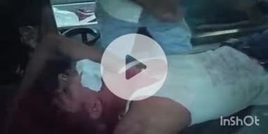 फतुहा: फोरलेन पर नूतन पेट्रोल पंप के पास सड़क हादसे में दो लोग घायल