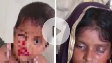 बाह: गांव नौगवां में मां के साहस से बची बेटी की जान, डीएम ने बढ़ाया हौसला