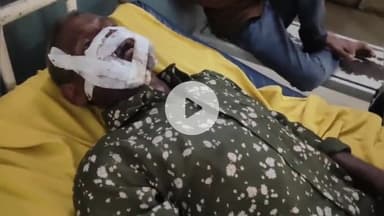 मथुरा: गांव भुडासानी में पालतू कुत्ते ने बुजुर्ग पर किया हमला, जबड़े को किया घायल, अस्पताल में कराया भर्ती