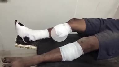 बख्तियारपुर: करौता जगदंबा मंदिर के पास फोरलेन पर खड़ी ट्रक में दूसरी ट्रक ने मारी टक्कर, चालक जख्मी; पटना रेफर