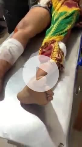 टीकमगढ़: सरानी: ज़मीनी विवाद में चाचा-भतीजे ने की मारपीट, चाकू से हमला, घायल अस्पताल में भर्ती