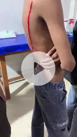 टीकमगढ़: स्टेड बैंक चौराहे पर दो लोगों से मारपीट, ब्लेड से हमला, घायल ज़िला अस्पताल में भर्ती