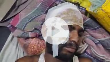 टीकमगढ़: दिनउ गांव में अनियंत्रित होकर बाइक सवार घायल, ज़िला अस्पताल रेफर