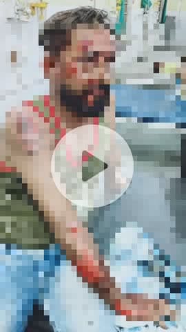 भुसावर: वैर सड़क मार्ग पर आवारा गौ वंश के हमले से एक बाइक सवार युवक घायल, अस्पताल में कराया गया भर्ती