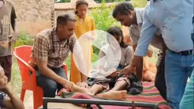 सिराथू: भैसहापर गाँव में एक लड़की को कई बार सांप काटने के मामले में मेडिकल टीम ने की जांच