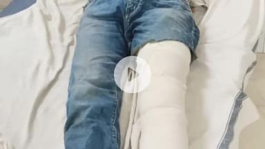 झालरापाटन: हबीब नगर में युवक के साथ मारपीट और चाकुओं से हमला करने के आरोपियों को किया गिरफ्तार, भागते समय 3 लोग हुए चोटिल