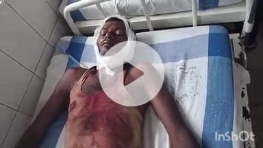 अरवल: अमरा चौकी गांव में भूमि विवाद में दो भाइयों के बीच मारपीट, चार लोग घायल