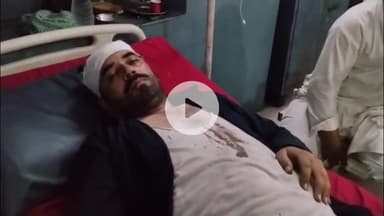 मथुरा: बरसाना क्षेत्र में होटल पर काम नहीं करने को लेकर 2 मजदूरों के साथ हुई मारपीट, अस्पताल में भर्ती