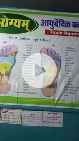 #आरोग्यम आयुर्वेदिक कांसा थाली टॉक्सिन रिमूवर सेंटर पर मिला घुटनों मैं 50% आ रहा हूं 2 दिन का रिजल्ट जीवाजीगंज मुरैना